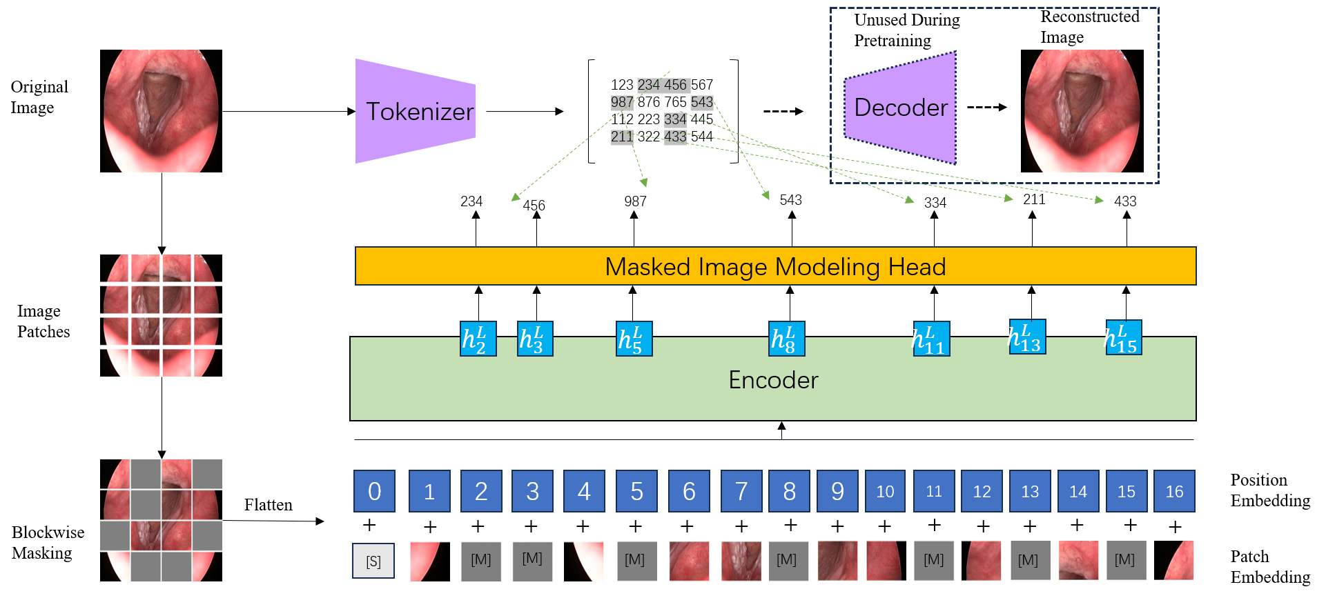 Self-Supervised Learning for Laryngoscopic Image Classification